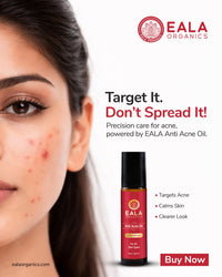 Eala Anti Acne Oil – Target It, Don't Spread It